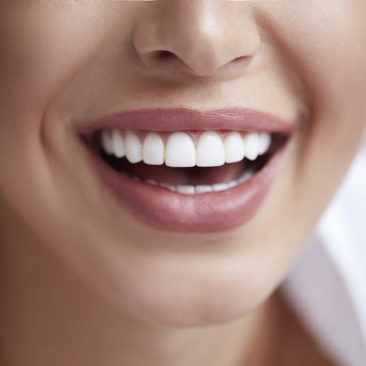 Close up of a woman with white teeth smiling