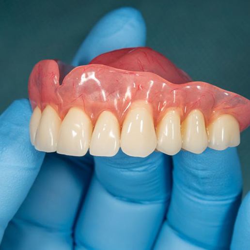 Gloved hand holding denture for upper arch