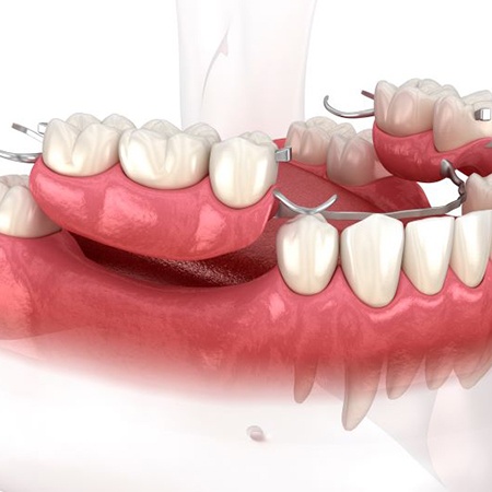 Set of full dentures against plain background