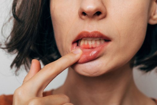 Woman with gum irritation