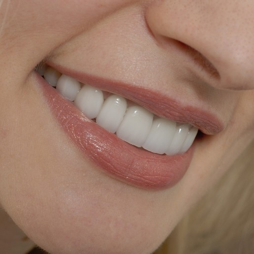 Close up of a blonde woman smiling with straight white teeth