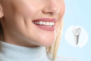 Woman smiling with a dental implant