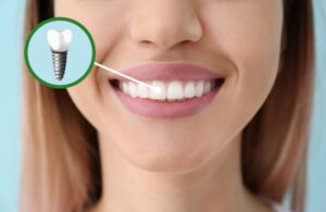 Woman smiling with a dental implant