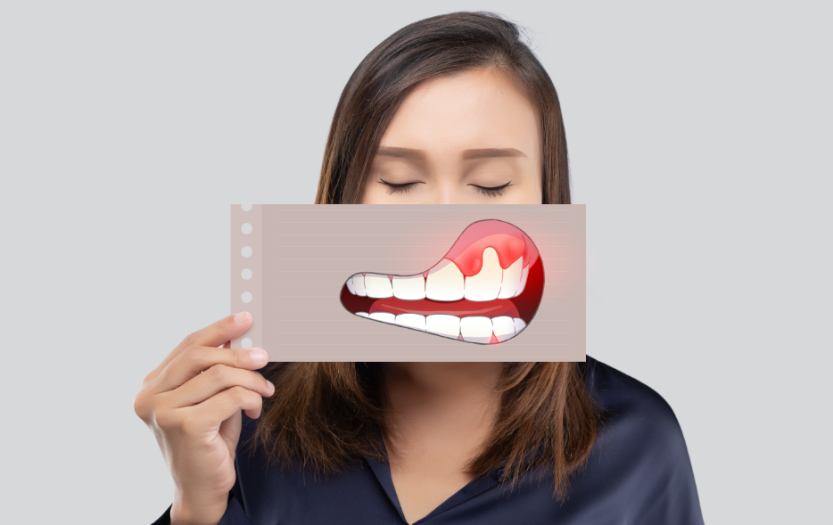 Woman holding cartoon of mouth and gums over her mouth